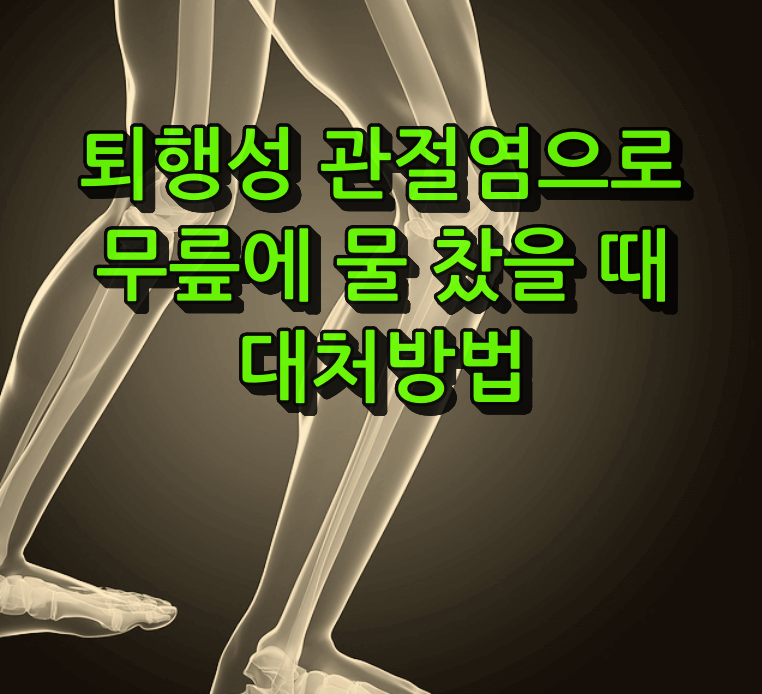 퇴행성관절염 대처방법