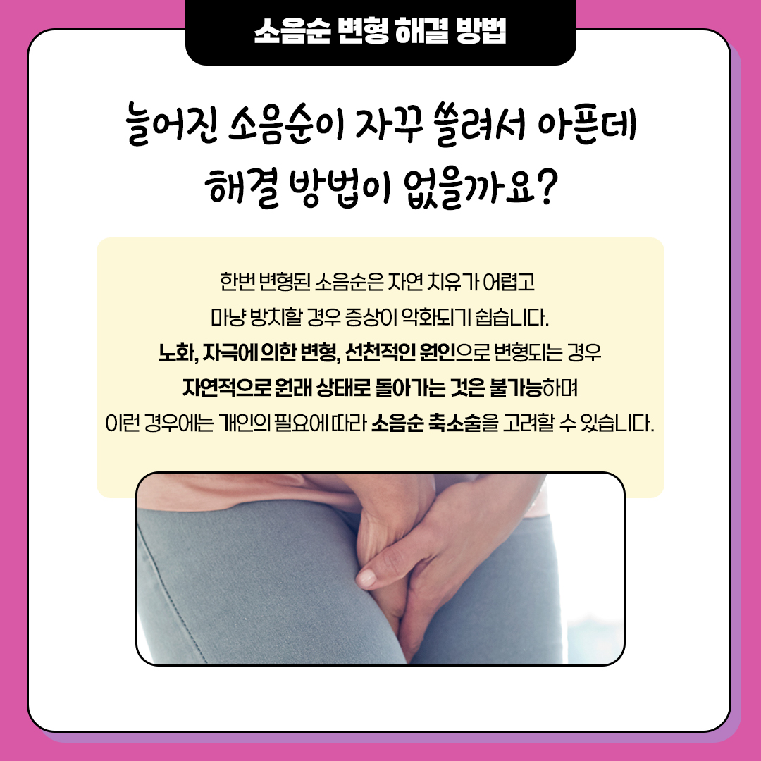 소음순 늘어남 자꾸 쓸려서 아픈데 해결 방법 없나요?