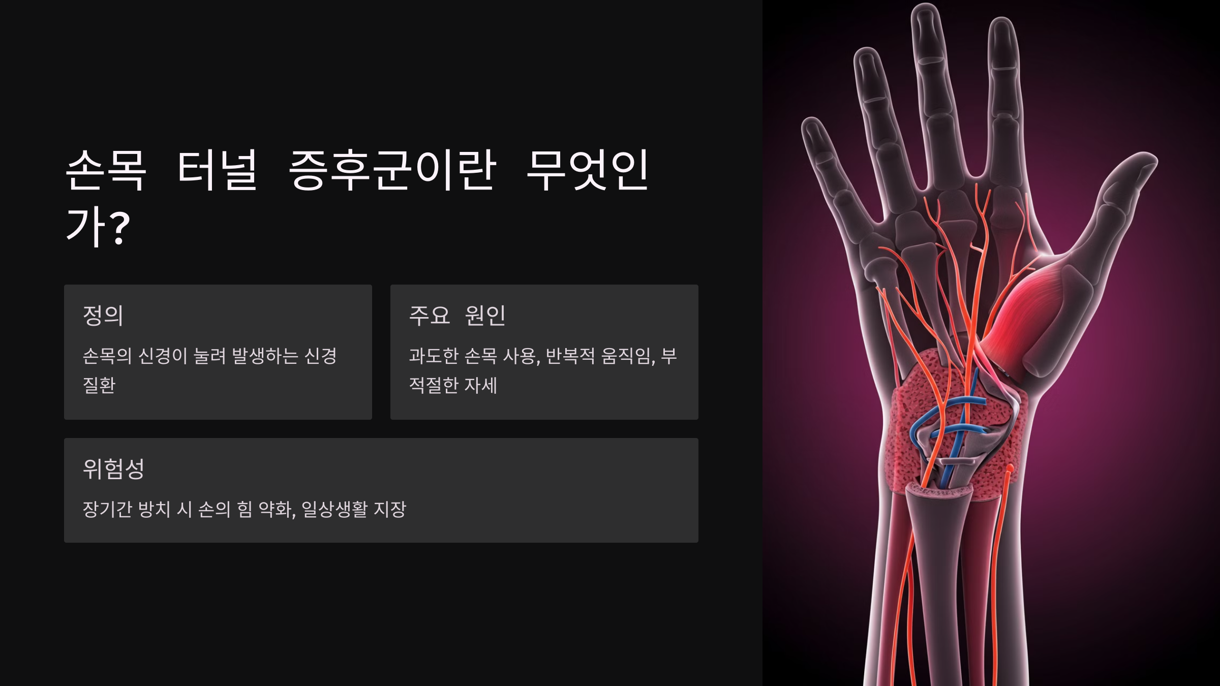 손목 터널 증후군이란 무엇인가?