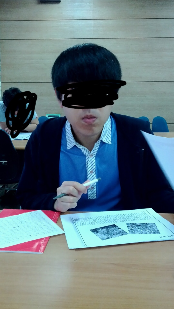  양악수술 4년차 후기 공개