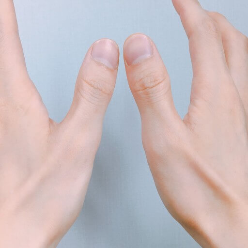 손가락 마디 통증 증상&amp;#44; 손가락 마디가 아픈 이유와 완화법