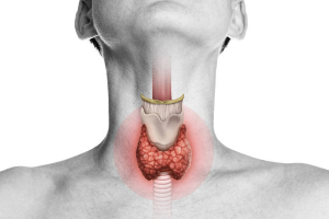 Understanding Hypothyroidism: A Condition with Symptoms Similar to Dementia.