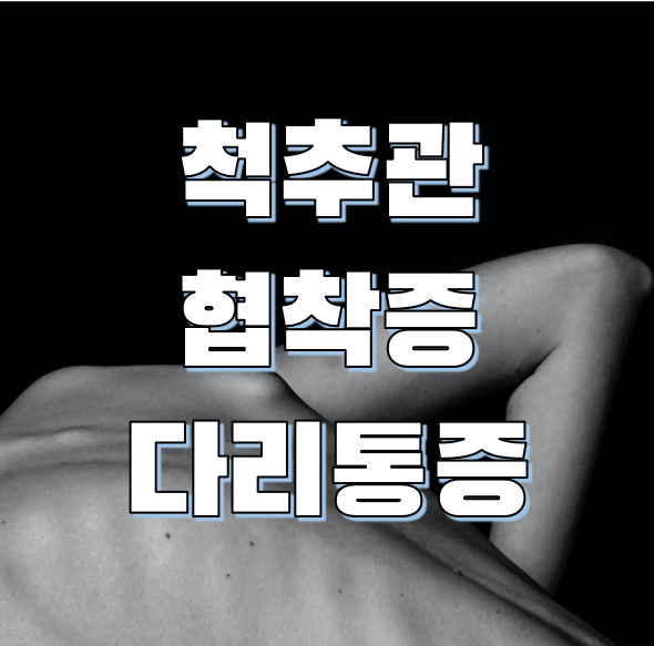 척추관 협착증의 다리 통증