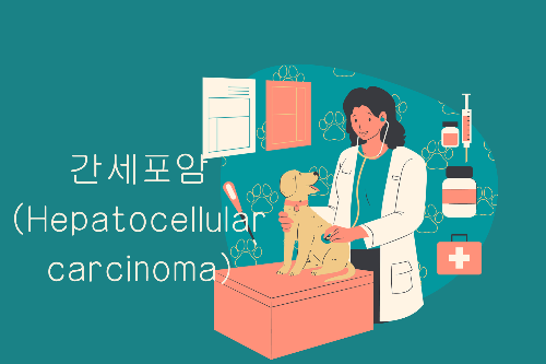 간세포암(Hepatocellular carcinoma)