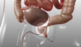  전립선암 초기 증상 및 원인 알아봤습니다.