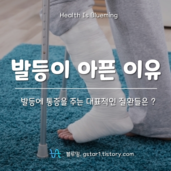 발이 아픈데 무슨일이야? 8