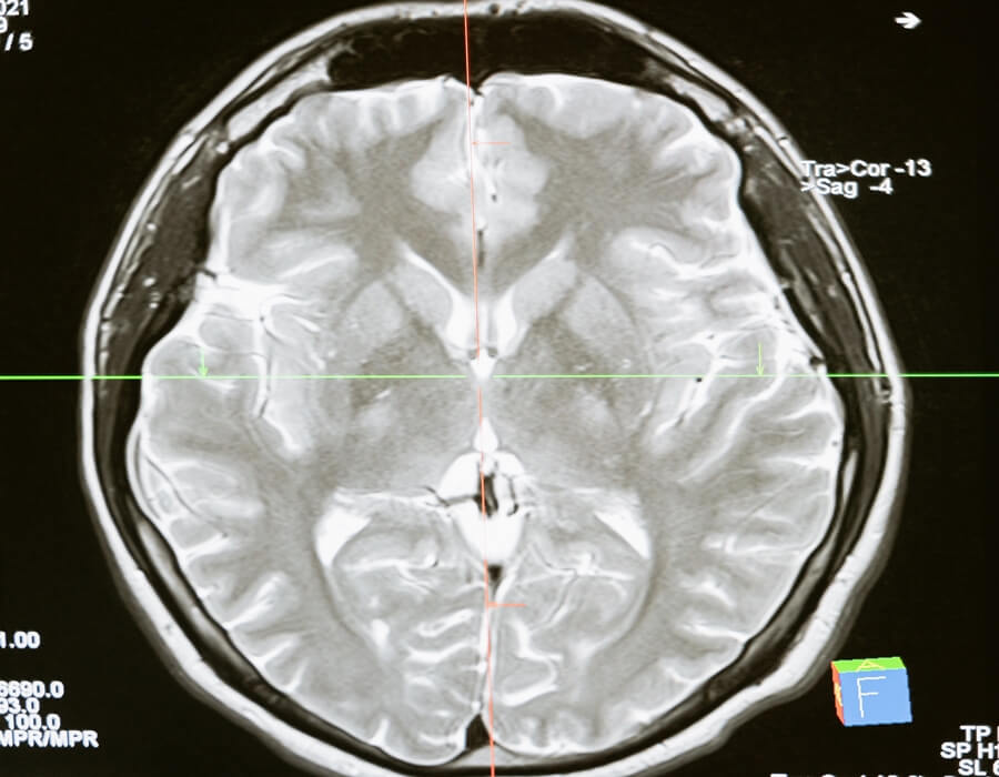 뇌-구조-엑스레이