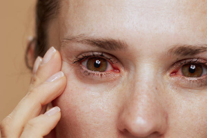 Understanding the Causes and Solutions for Eyelid Twitching.