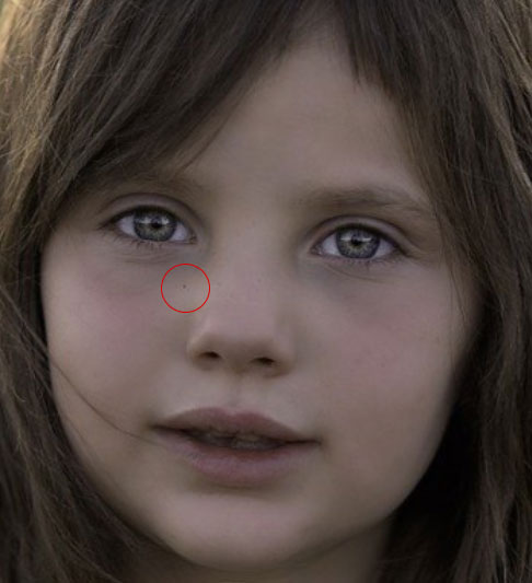 피부 잡티 제거 이미지 1