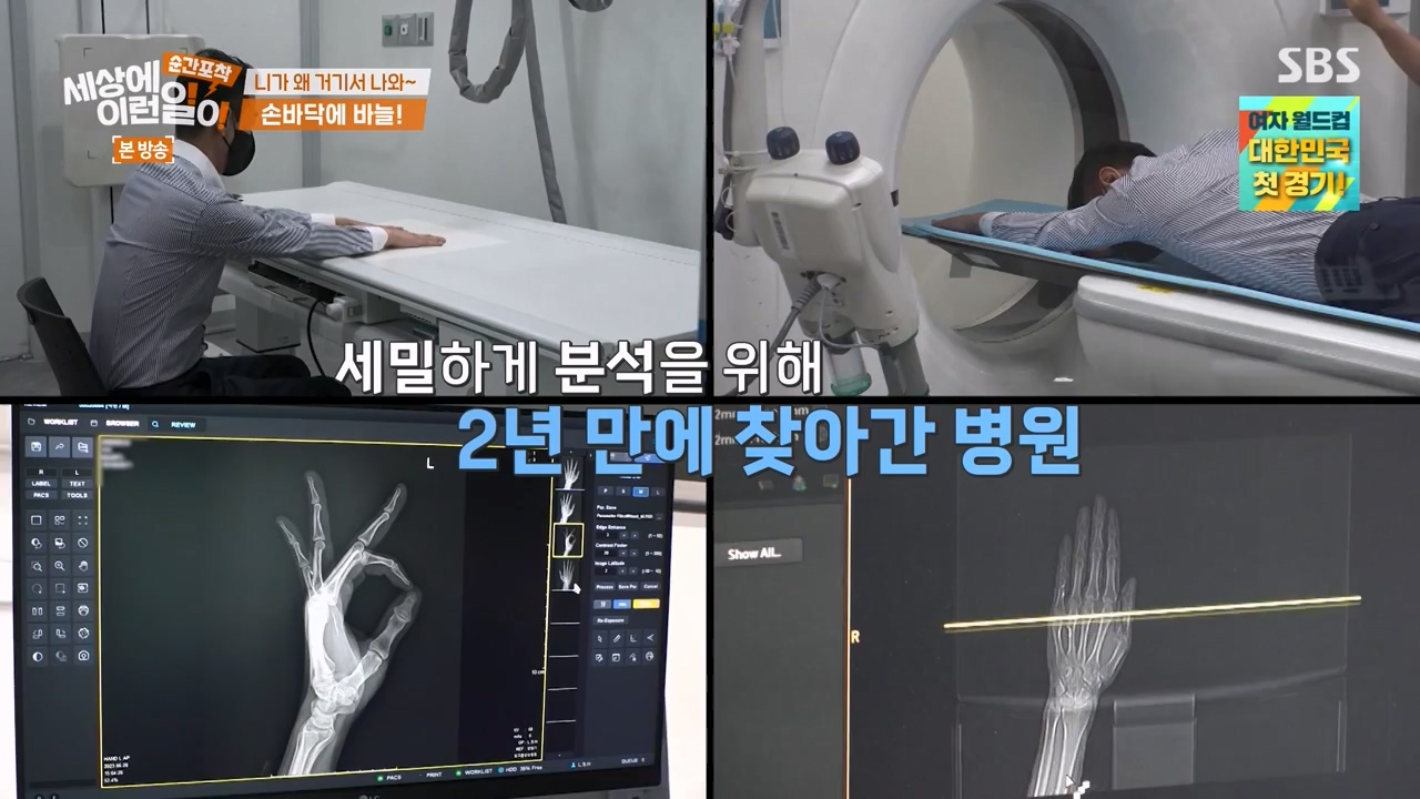 순간포착 세상에 이런일이.E1238.230723p-NEXT.mp4_20230724_205445.557.jpg