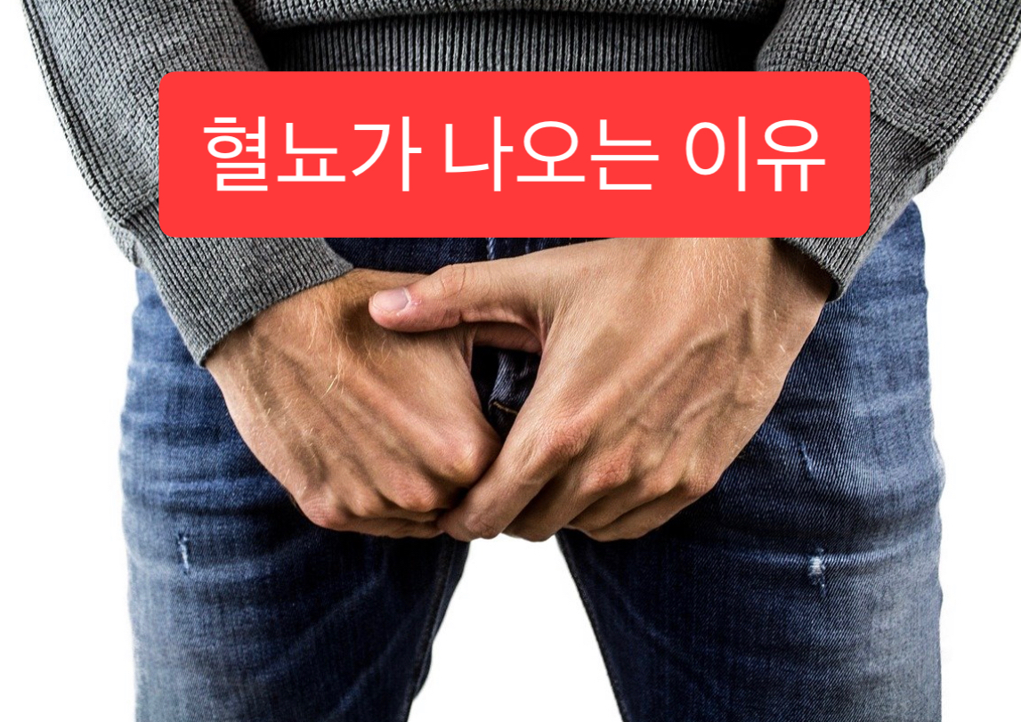  혈뇨가 나오는 이유는?