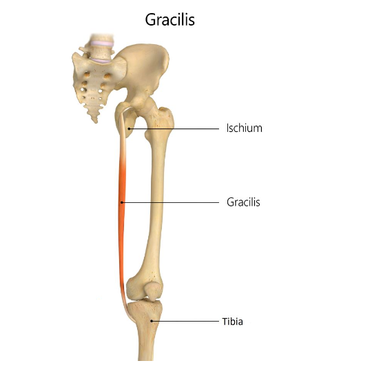 Gracilis