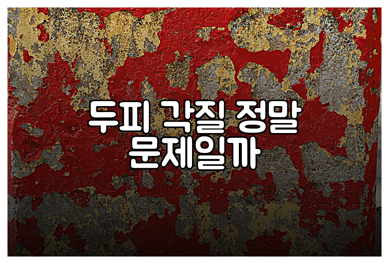 두피 각질 정말 문제일까