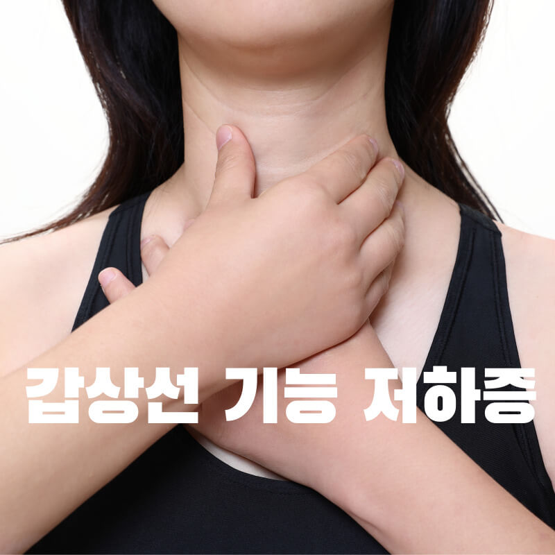 갑상선 기능 저하증