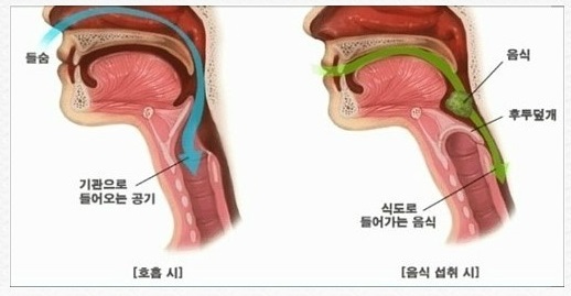  기도로 음식물이 넘어갈 수 있을까?