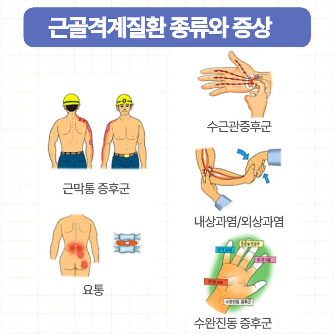 근골격계질환 종류와 증상