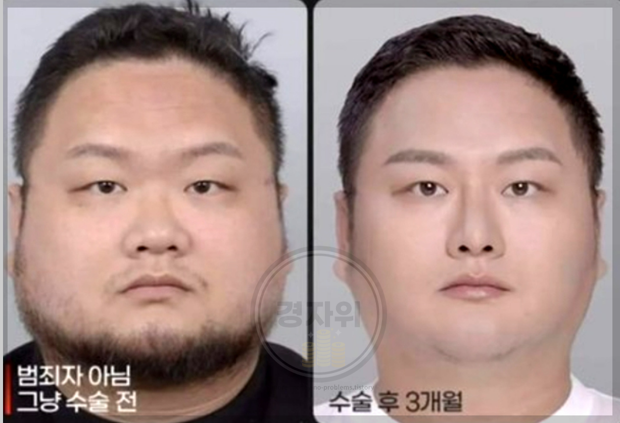 구제역-성형전