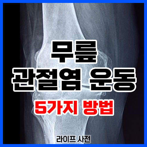 무릎 관절염 운동