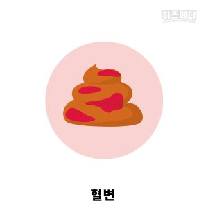 과민성 대장 증후군 진단 치료