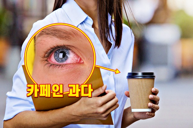 눈밑이 떨리는 증상 이유, 카페인 부작용
