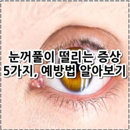 눈꺼풀이 떨리는 증상 5가지, 예방법 알아보기