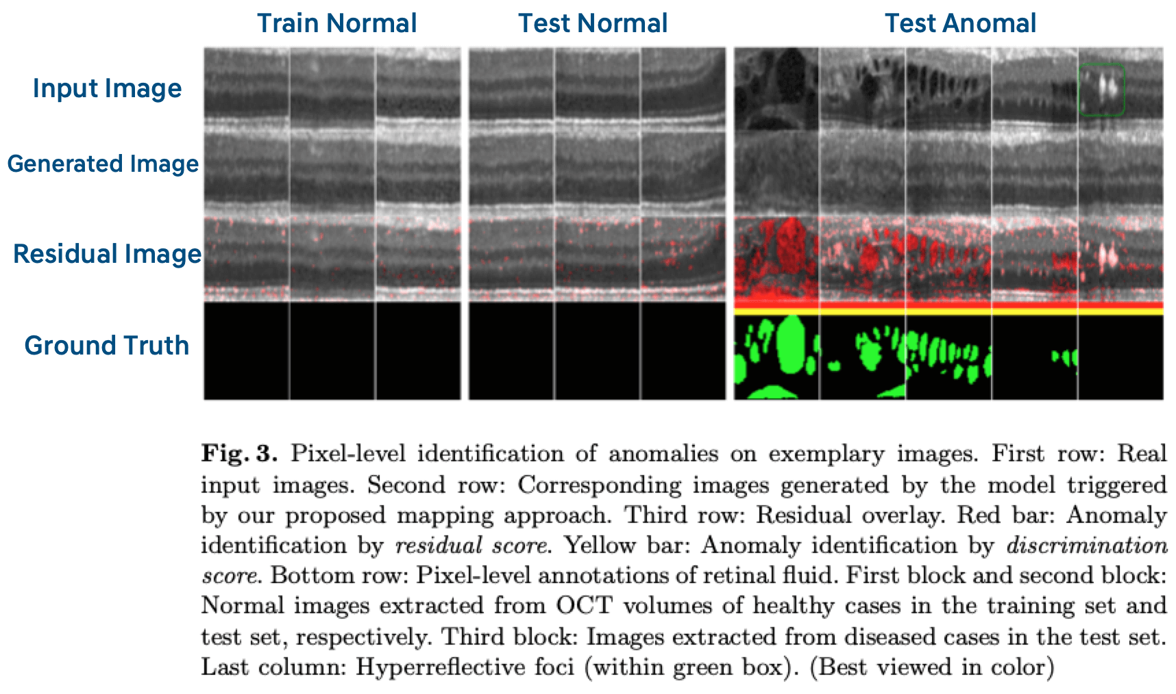 12.retinal scan 데이터셋 이미지 샘플 비교