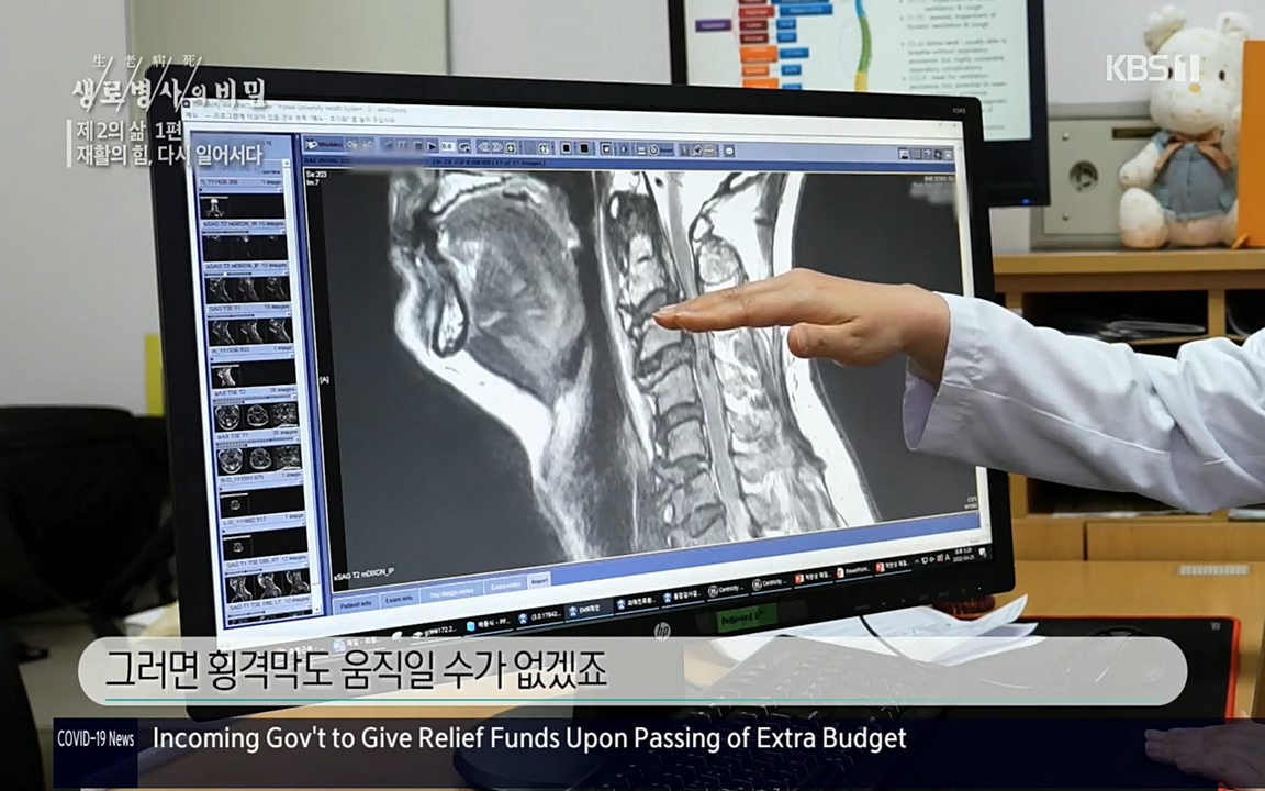 생로병사의 비밀.E819.220505p.H264-F1RST.mp4_20220508_182950.532.jpg