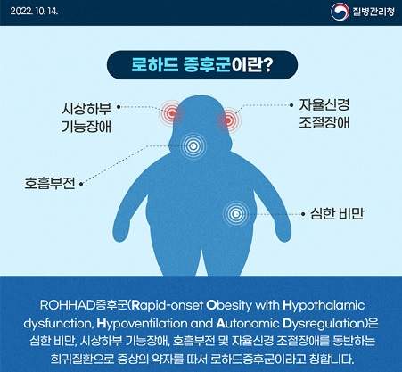 로하드 증후군이란 출처-질병관리청