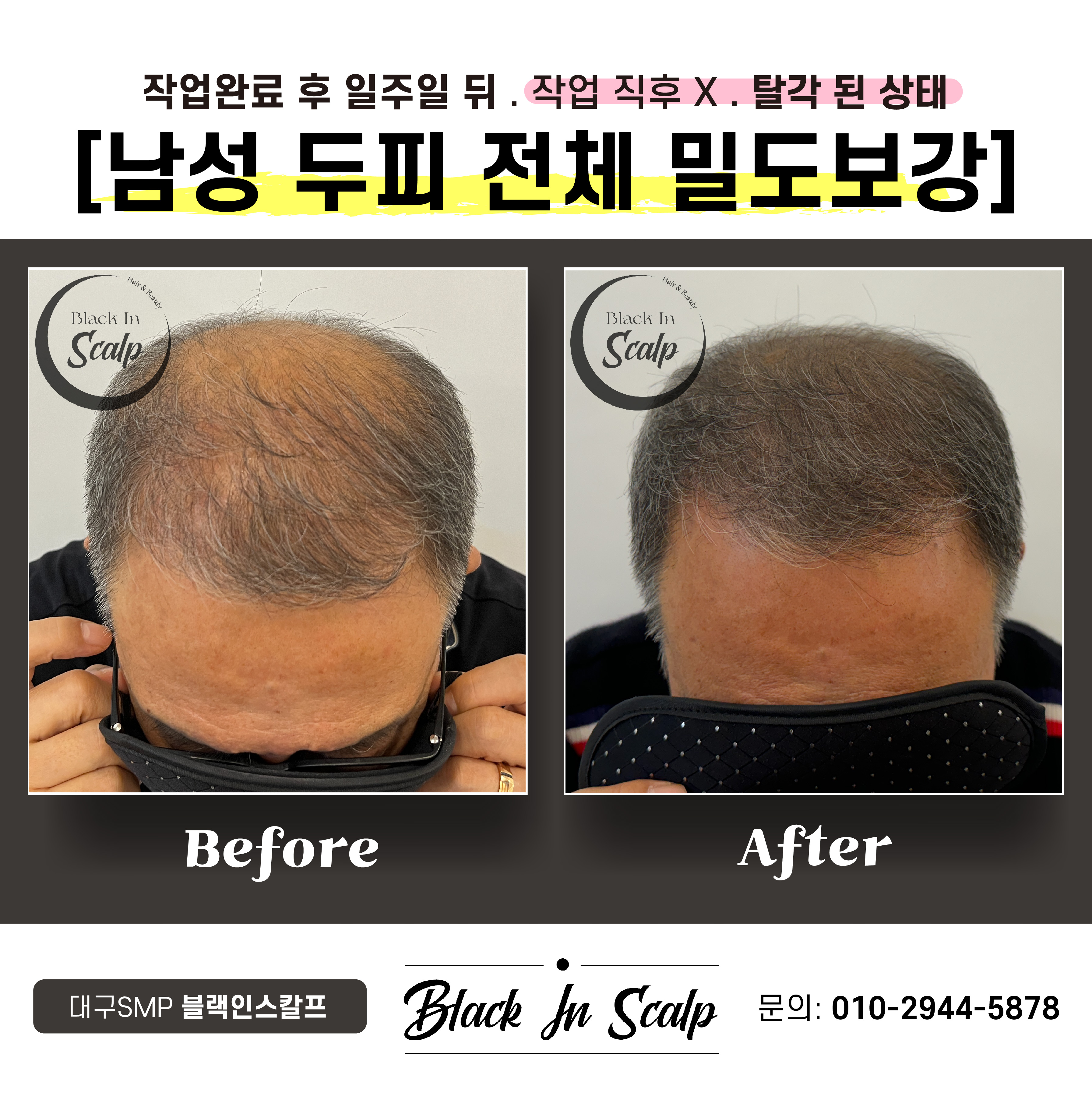 블랙인스칼프 이미지