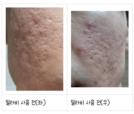  밀라비 클렌저(폼클렌징) 사용후기 및 밀랍랩 만들기!!