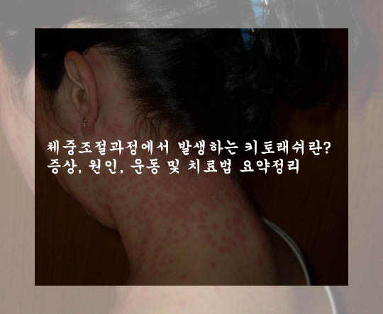  체중조절과정에서 발생하는 키토래쉬란? 증상, 원인, 운동 및 치료법 요약정리