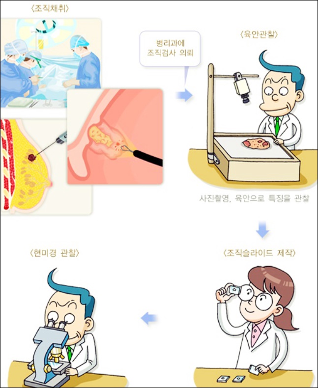 병리 조직검사 피부 조직검사 방법, 부작용