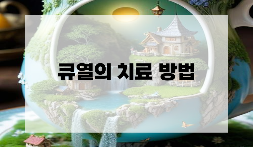 큐열의 치료 방법