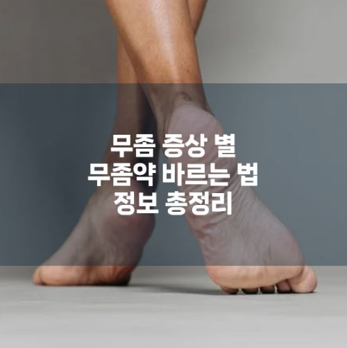 무좀 증상 별 무좀약 바르는 법