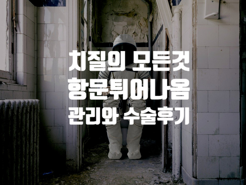  항문튀어나옴 - 경험자의 팁과 수술후기까지 (치질)