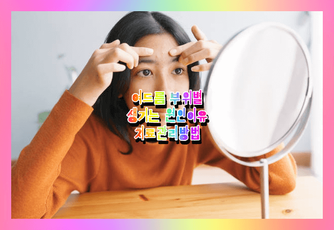  여드름 얼굴 부위별 원인 증상치료 흉터 없애는 방법 (좁쌀 화농성 여드름 압출치료 여드름레이저치료비용, 여드름치료잘하는병원)