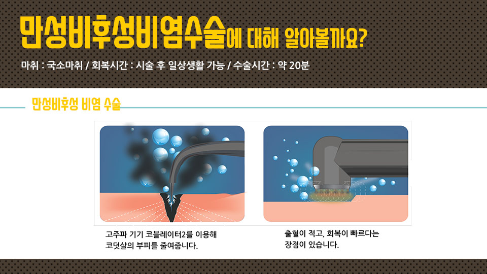 만성비후성비염수술