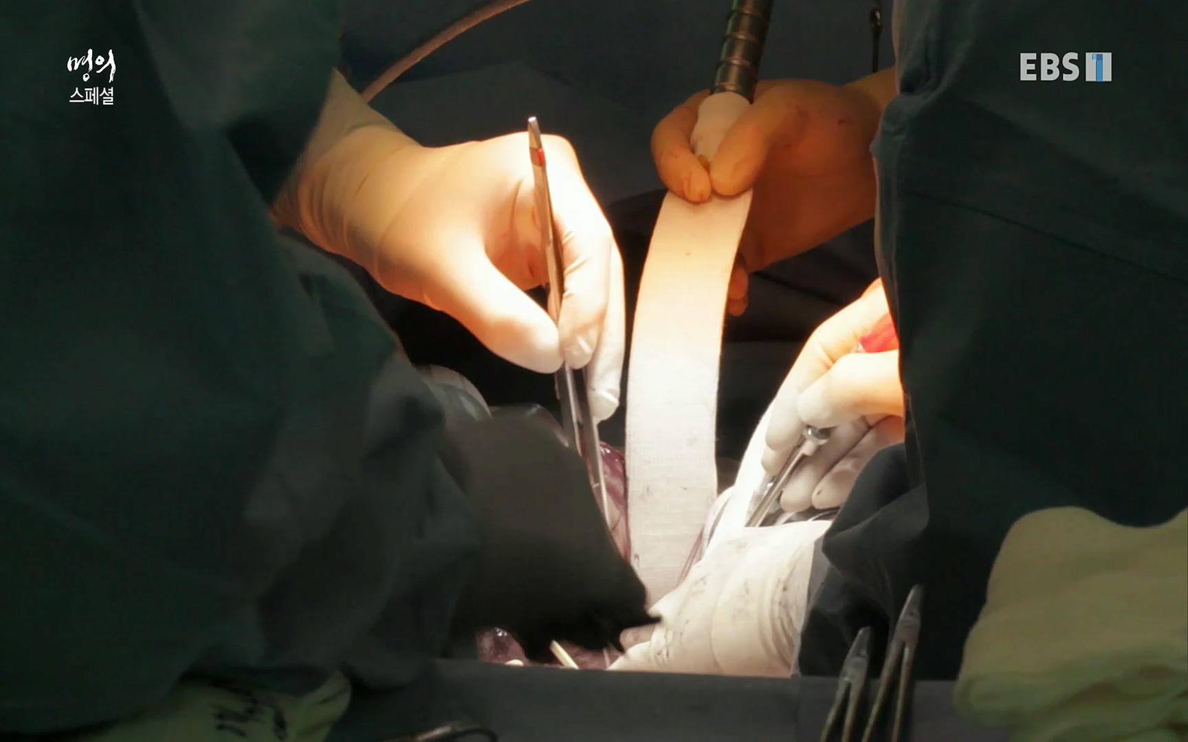 EBS 명의 헬스케어 - TV - 교육의 중심 EBS[명의 스페셜] 공포의 암, 췌장암, 담도암, 담낭암.mp4_20220902_210903.710.jpg