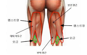 오금이 아픈 이유