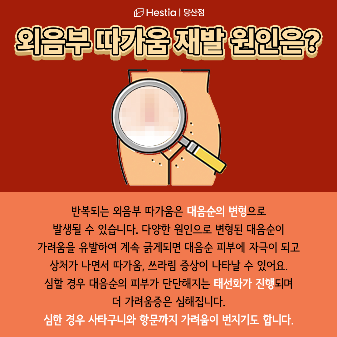 외음부따가움 재발 원인은?