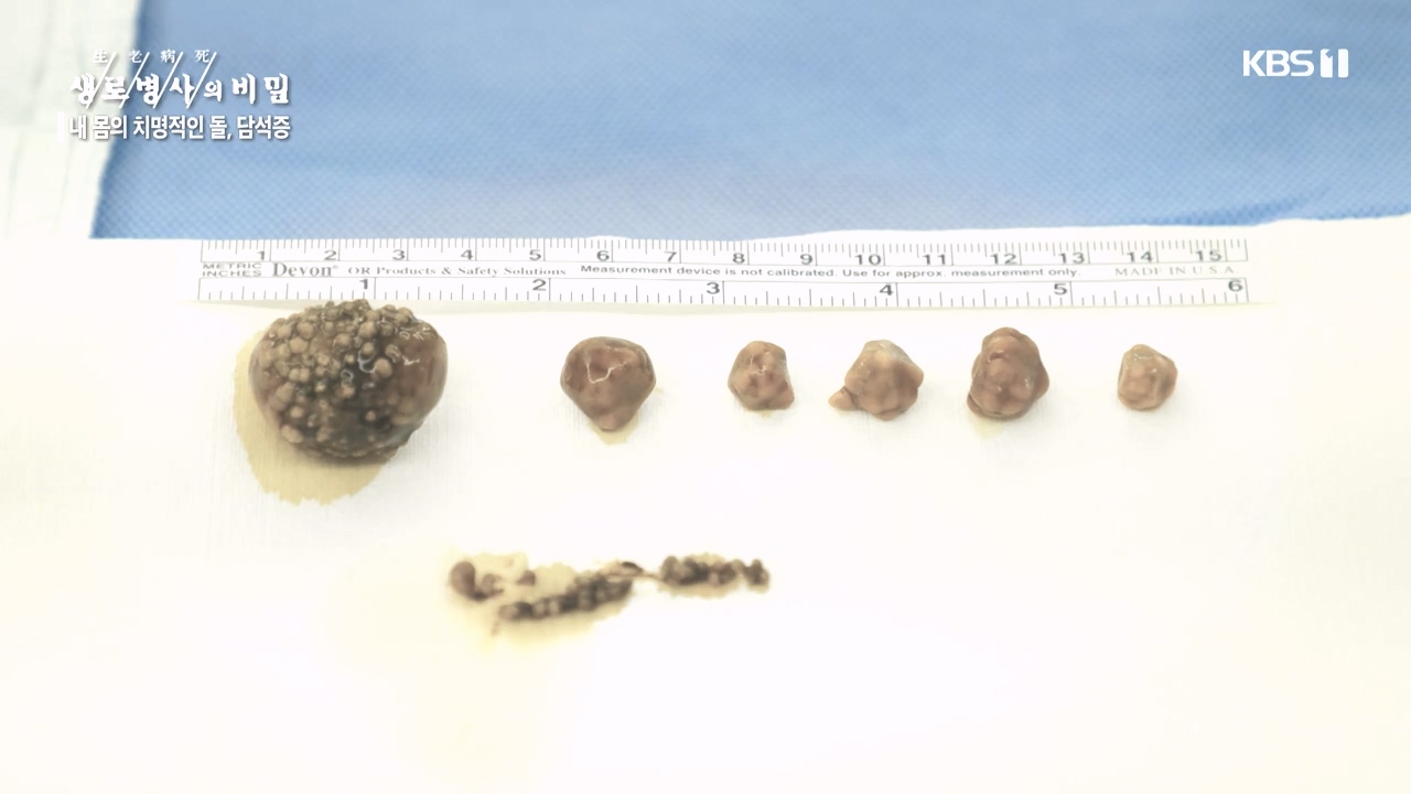 생로병사의 비밀.E886.231019p-NEXT.mp4_20231019_201644.512.jpg