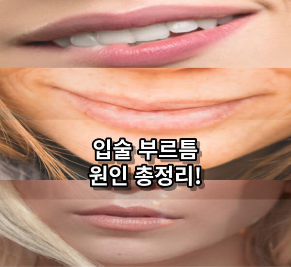 입술 부르틈 원인들과 증상