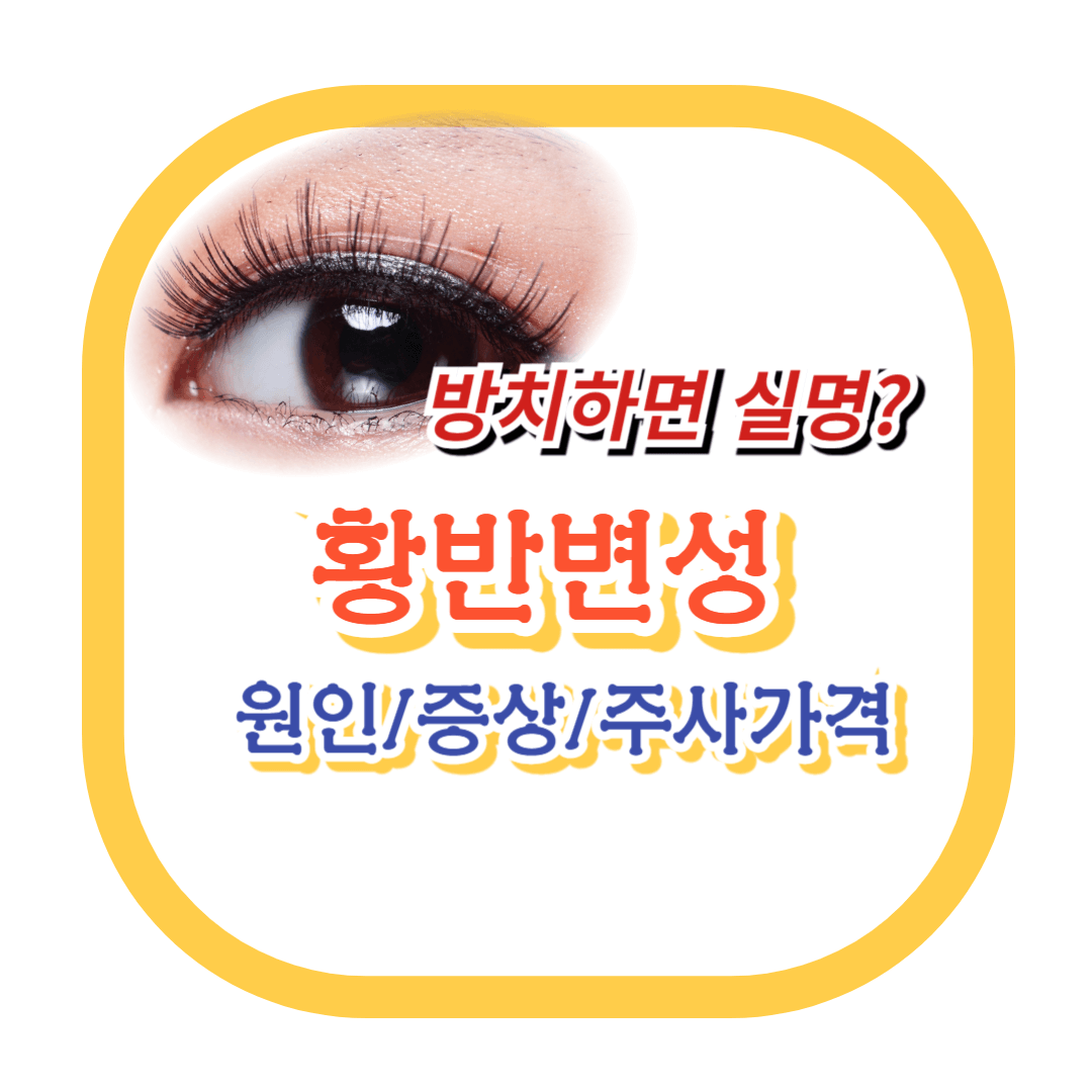 황반변성-원인-증상-치료법-주사가격