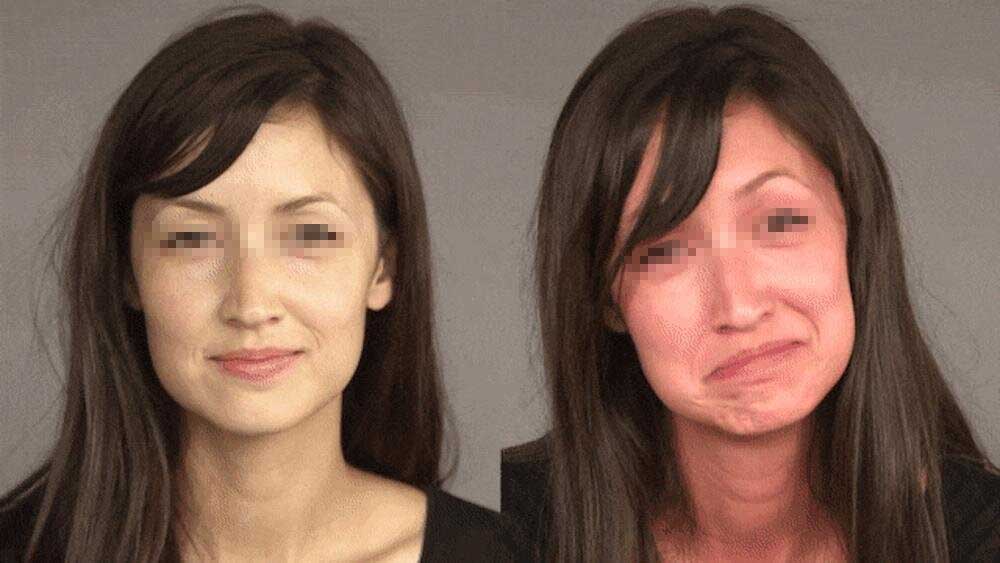 Drinking alcohol causes your face to turn red