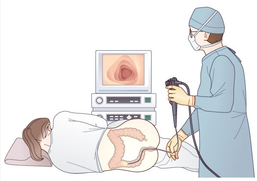  대장내시경 약복용과 음식조절은 어떻게? 지켜야할 사항!
