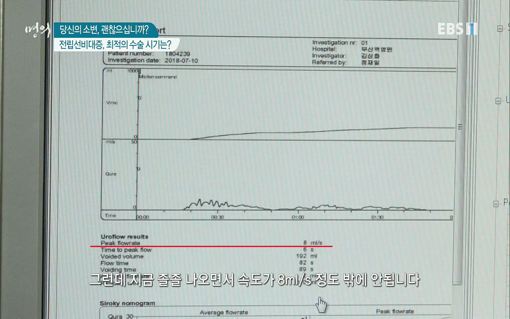 EBS 명의 헬스케어 - TV - 교육의 중심 EBS당신의 소변, 괜찮으십니까-.mp4_20220909_201558.514.jpg