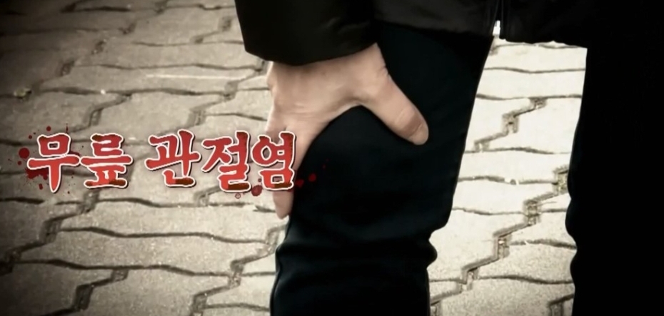  무릎관절염예방맞서는법 두충효능무릎통증없애는두충약선탕만드는법 엄지의제왕 450회 0907