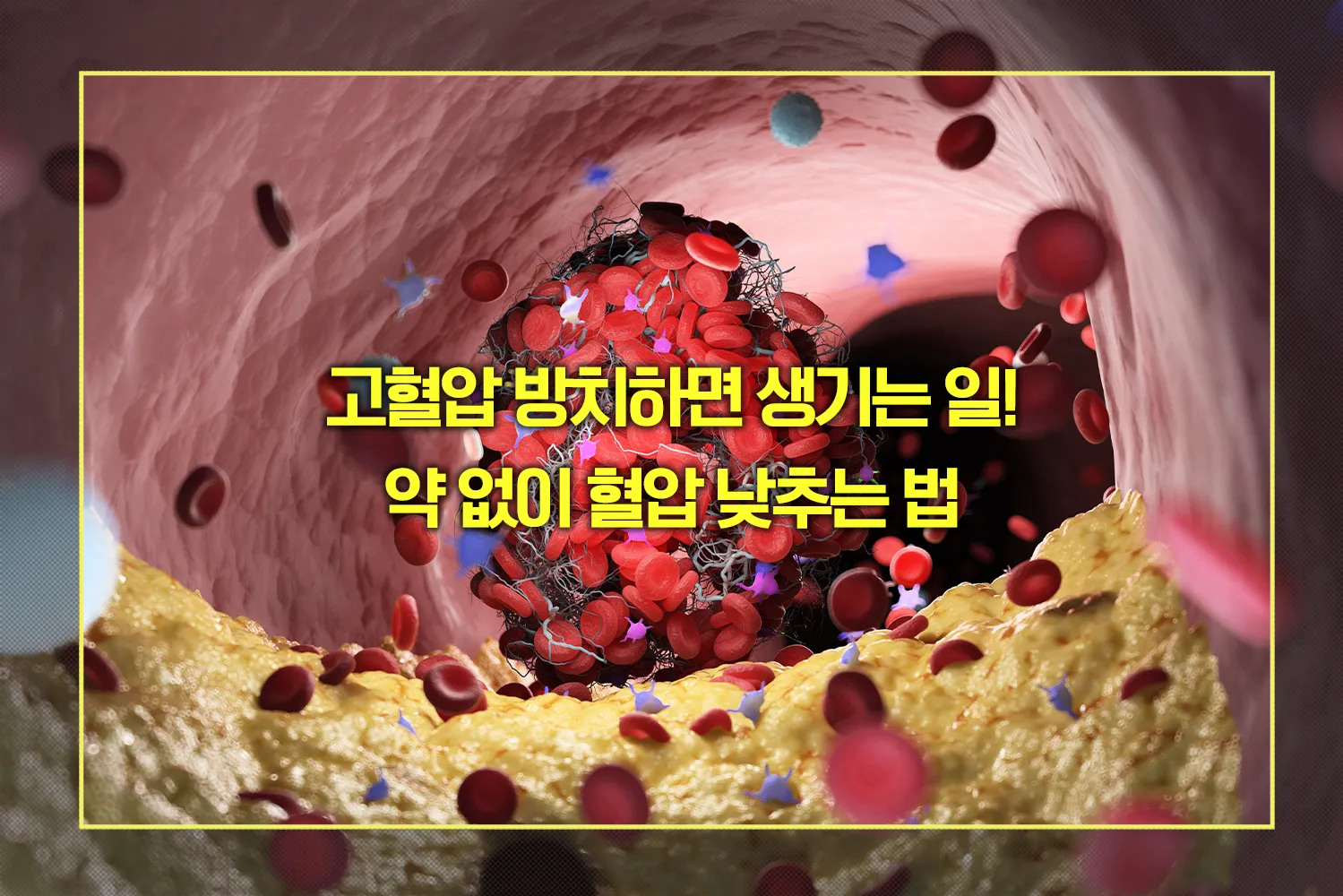 고혈압 약 없이 혈압 낮추는 법