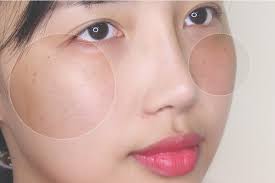 미소스킨케어 이미지