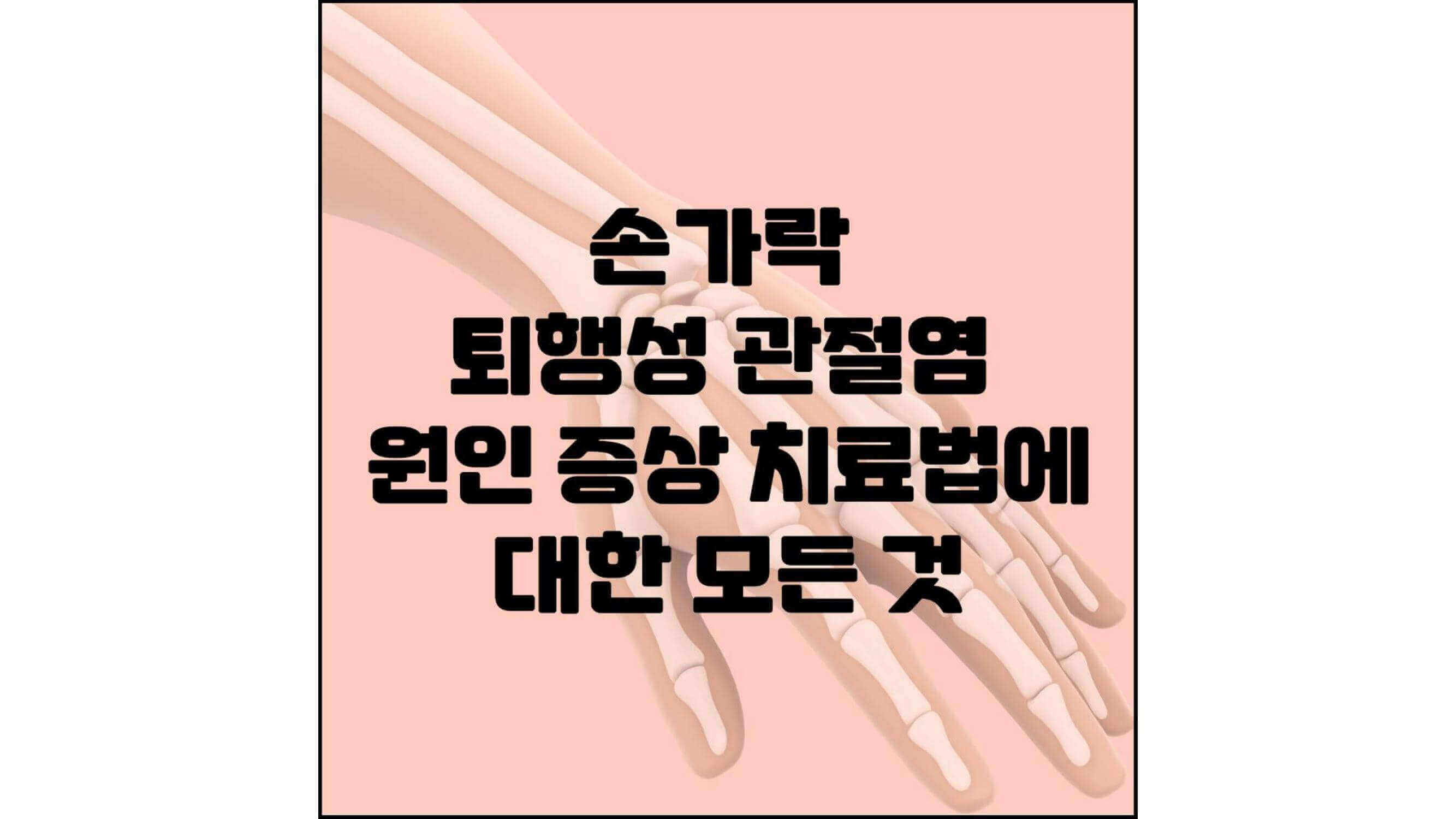 손가락-퇴행성-관절염-원인-증상-치료법에-대한-모든-것-섬네일